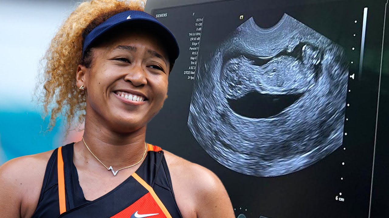 Naomi-Osaka-announced-her-first-pregnancy--17-61.jpg